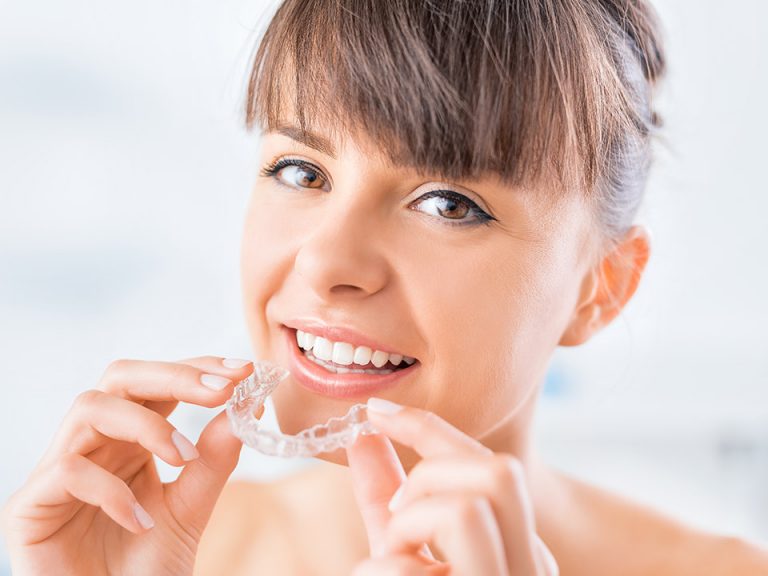 Invisalign treatments