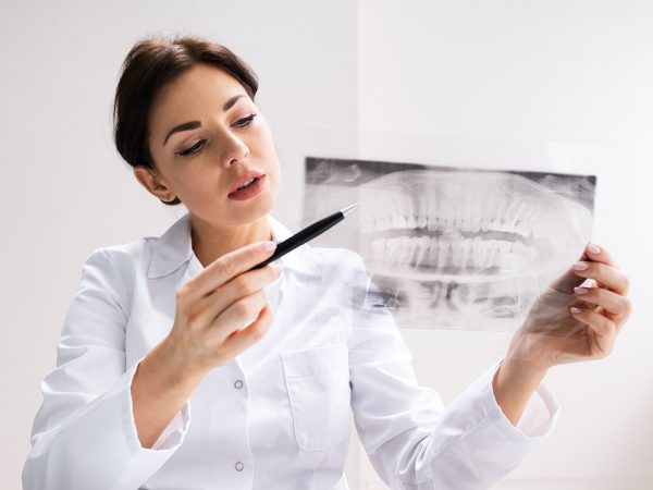 allaboutsmile-dental-Wisdom-Teeth Wisdom Teeth