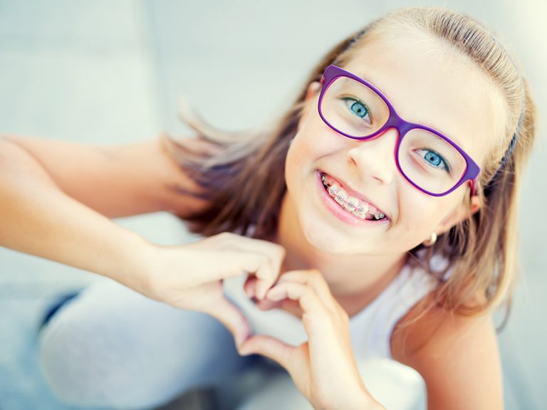 Kids Braces