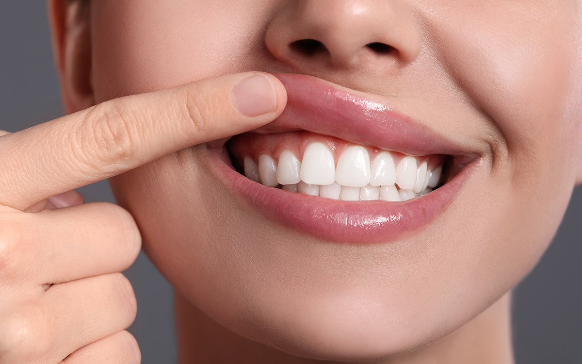 woman with gum disease