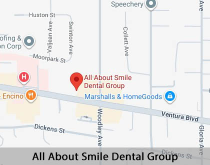 Map image for Options for Replacing Missing Teeth in Encino, CA